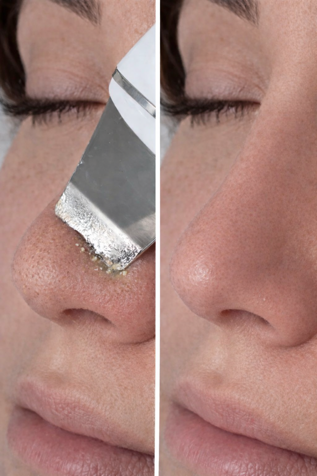SkinPulse 3X